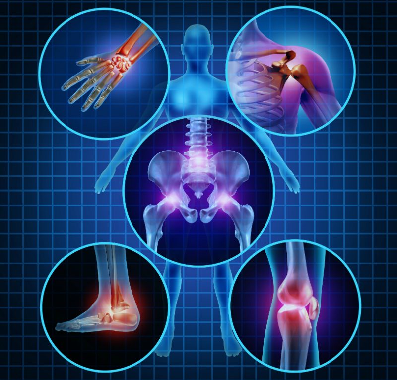 Three Signs You Need to See a Doctor for Arthritis in Jacksonville