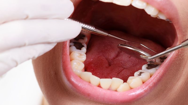Restore Function, Beauty, and Confidence with Custom Dental Bridges in Atlanta
