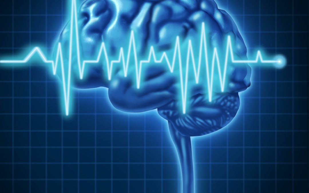 Innovative Brain Surgery Techniques Thriving in Springs, AR: A Comprehensive Guide