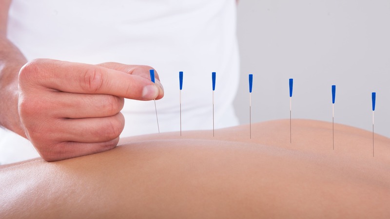 Transform Your Health with Acupuncture for Stress Berkeley CA