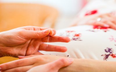 Natural Relief Solutions Include Acupuncture For Stress In Bellingham, WA: Treatment Benefits