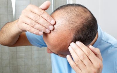 Regain Confidence by Choosing PRP Hair Restoration at Harmony Aesthetics in Spring, TX
